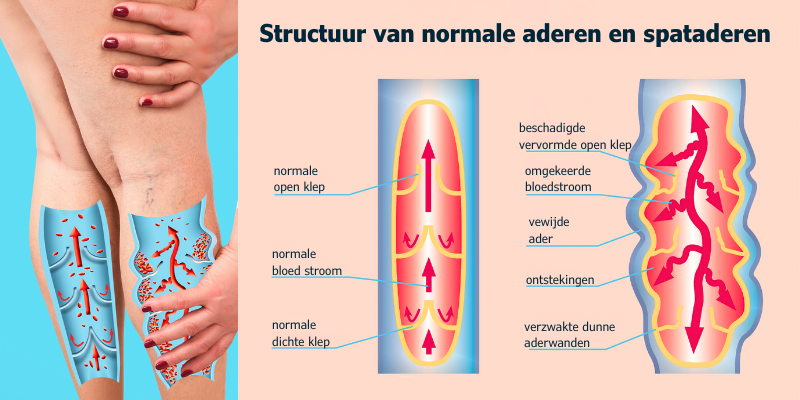 spataderen en gewone aderen